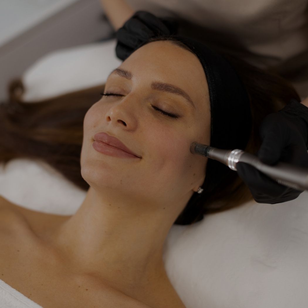 Microneedling Beautylife